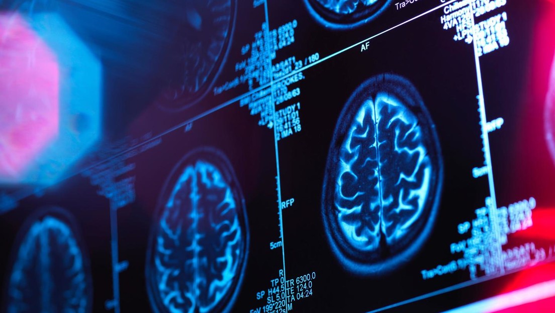 US-Regierung bringt Alzheimer mit Rassismus in Verbindung